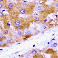 HADH Antibody