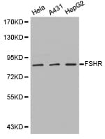 Polyclonal Rabbit anti-Human FSH Receptor / FSHR Antibody (WB)