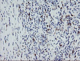 F13A1 / Factor XIIIa Antibody (clone OTI9E2)