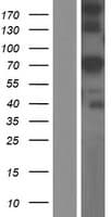 GLB1L Protein (Over-Expression Lysate Myc-DDK (Flag))