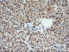 MLANA / Melan-A Antibody (clone OTI1F12)