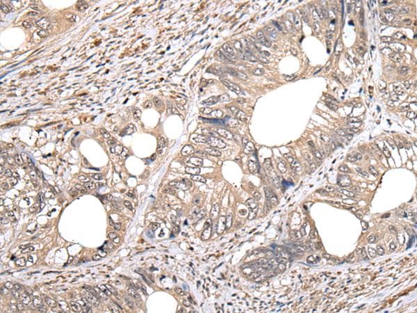 N-acetyllactosaminide beta-1,6-N-acetylglucosaminyl-transferase, isoform C Antibody