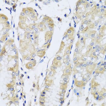 Polyclonal Rabbit anti-Human FANCA Antibody (IHC, WB)