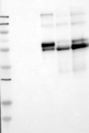 IHC-plus™ Complement C2 Antibody (clone 5C3)