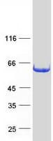 Human IFIT3 Protein (Recombinant Myc-DDK (Flag))