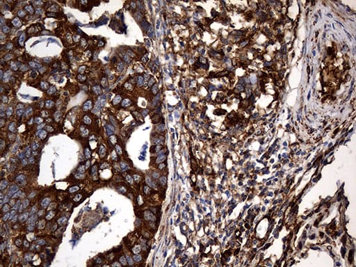 RGS10 Antibody (clone OTI1B10)