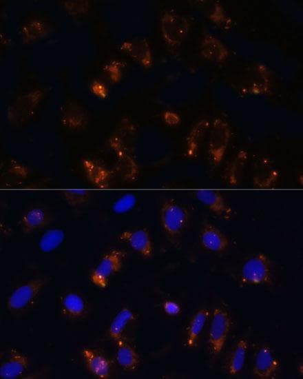 TGFB1 / TGF Beta 1 Antibody