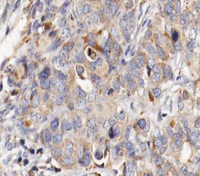 Polyclonal Rabbit anti-Human MUC13 Antibody (IHC, IF, WB)
