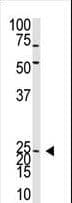 NEUROG2 / NGN2 / Neurogenin 2 Antibody (aa242-272)