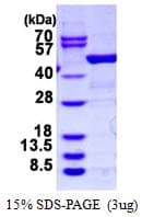 Human ARHGDIB / D4 GDI Protein (Recombinant)