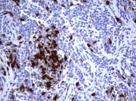Monoclonal Mouse anti-Human TS / Thymidylate Synthase Antibody (clone OTI1D6, IHC, WB)