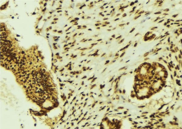 Polyclonal Rabbit anti-Human BRF1 Antibody (IHC, IF, WB)