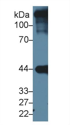 ACTC1 / Alpha Cardiac Actin Antibody (aa156-368)