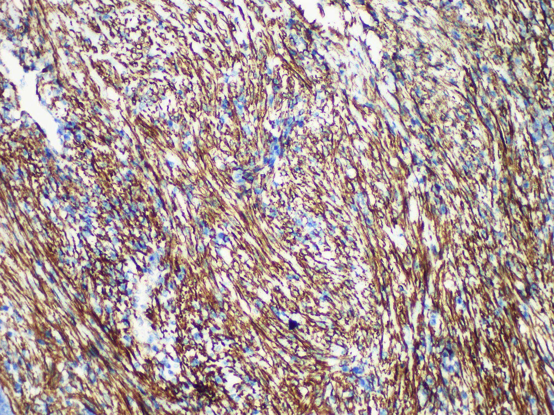 CALD1 / Caldesmon Antibody