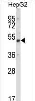 Polyclonal Rabbit anti-Human UBP1 Antibody (aa266-295, IHC, IF, WB)