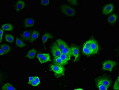 IHC-plus™ Polyclonal Rabbit anti-Human GOT2 Antibody (IHC, WB)