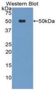 LP-PLA2 / PLA2G7 Antibody (aa22-441)