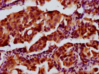 Polyclonal Rabbit anti-Human ACLP / AEBP1 Antibody (aa46-234, IHC, IF)