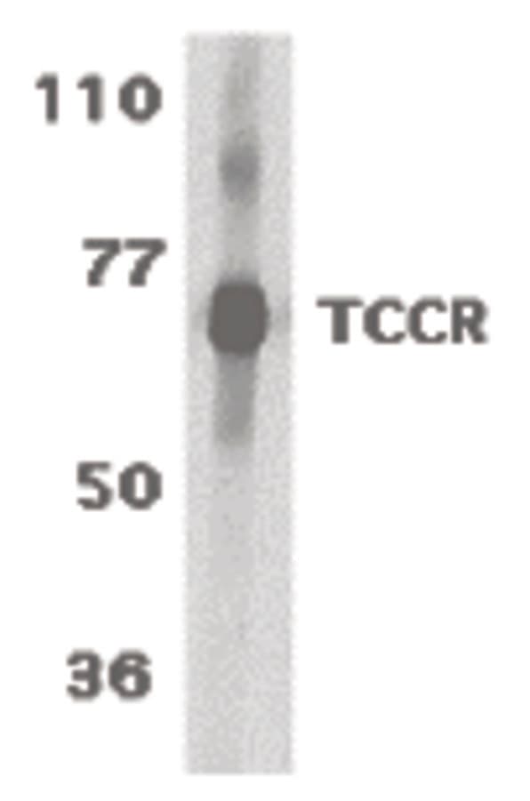 IHC-plus™ Polyclonal Rabbit anti-Human IL27RA Antibody (IHC, IF, WB)