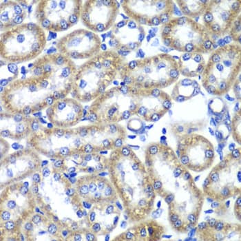 TMED10 / TMP21 Antibody