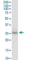 Monoclonal Mouse anti-Human CDX1 Antibody (clone 2D8, IF, WB)