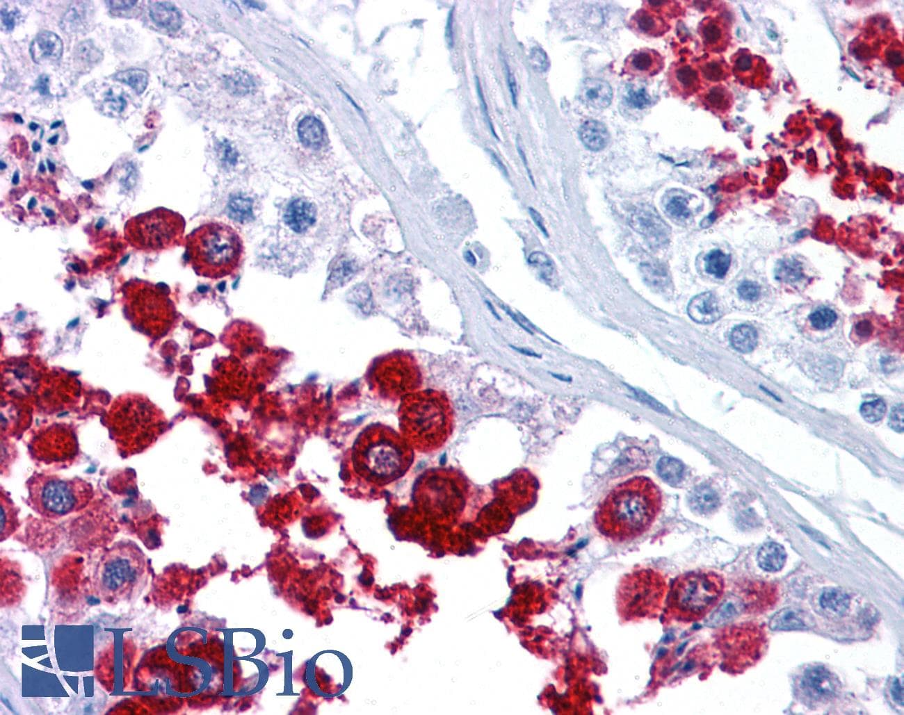 IHC-plus™ MSY2 / YBX2 Antibody
