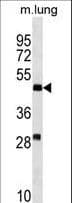 Polyclonal Rabbit anti-Human RNF150 Antibody (aa60-87, WB)