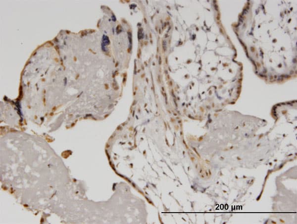HELZ Antibody (clone 5B2)