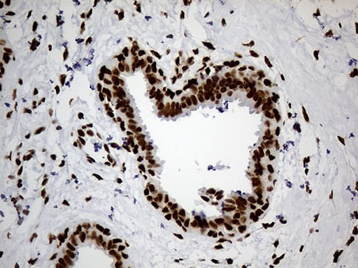 Monoclonal Mouse anti-Human HNRNPH1 / hnRNP H Antibody (clone OTI2E8, Carrier-free, IHC, WB)