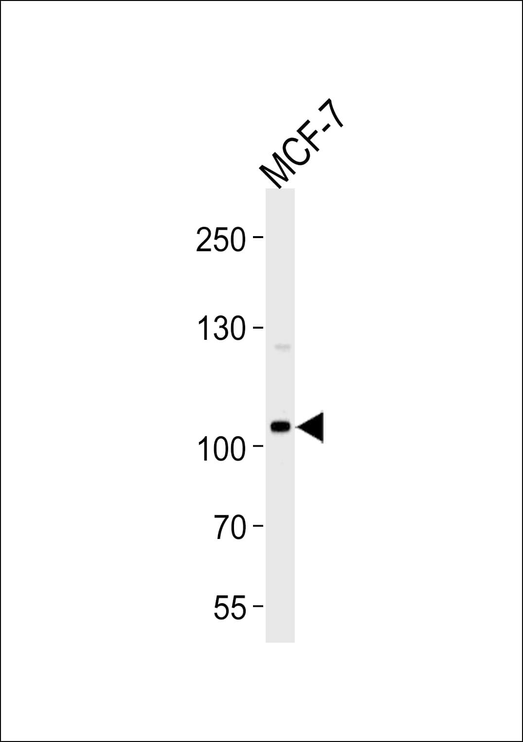 SULF2 / Sulfatase 2 Antibody (aa824-852)