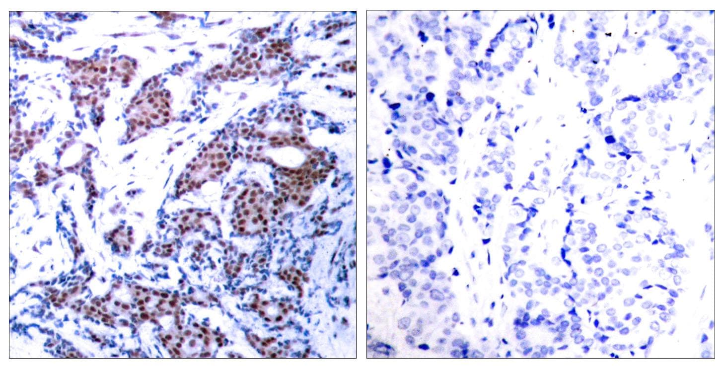JUN / c-Jun Antibody (phospho-Ser73)