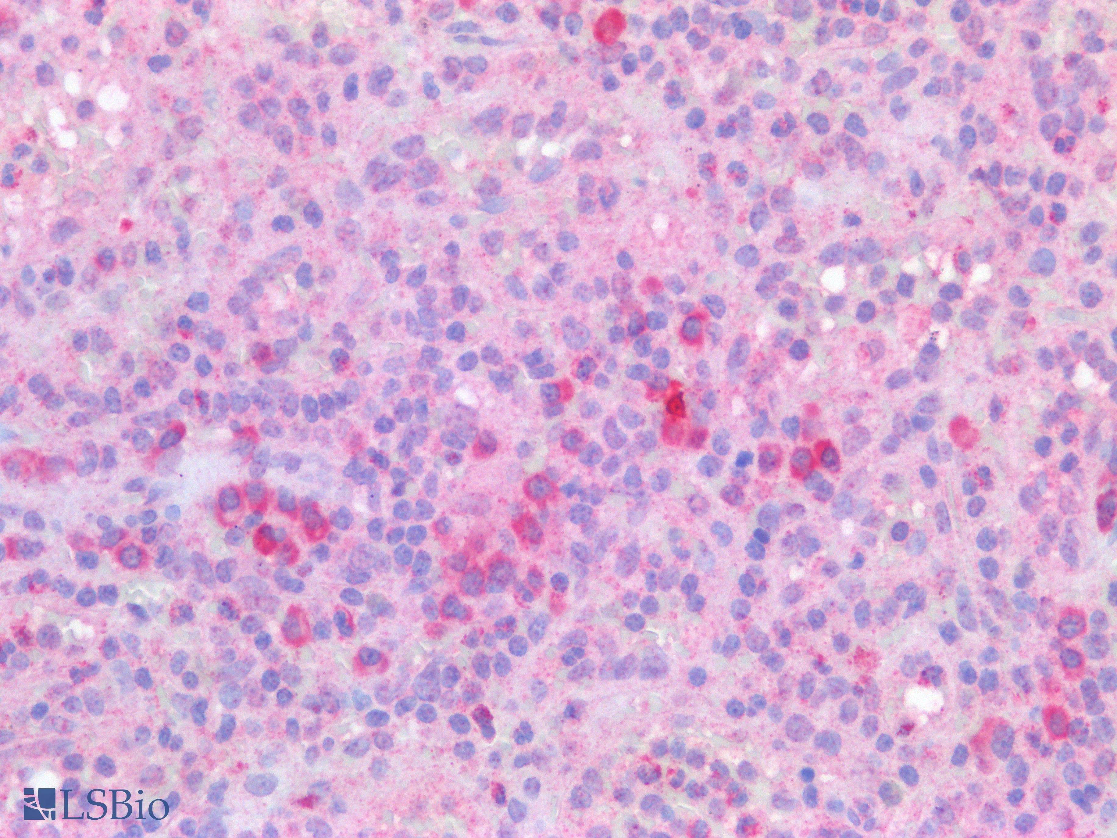 PathPlus™ TGFB1 / TGF Beta 1 Antibody