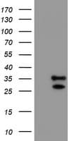UCHL1 / PGP9.5 Antibody (clone OTI2B5, Carrier-free)