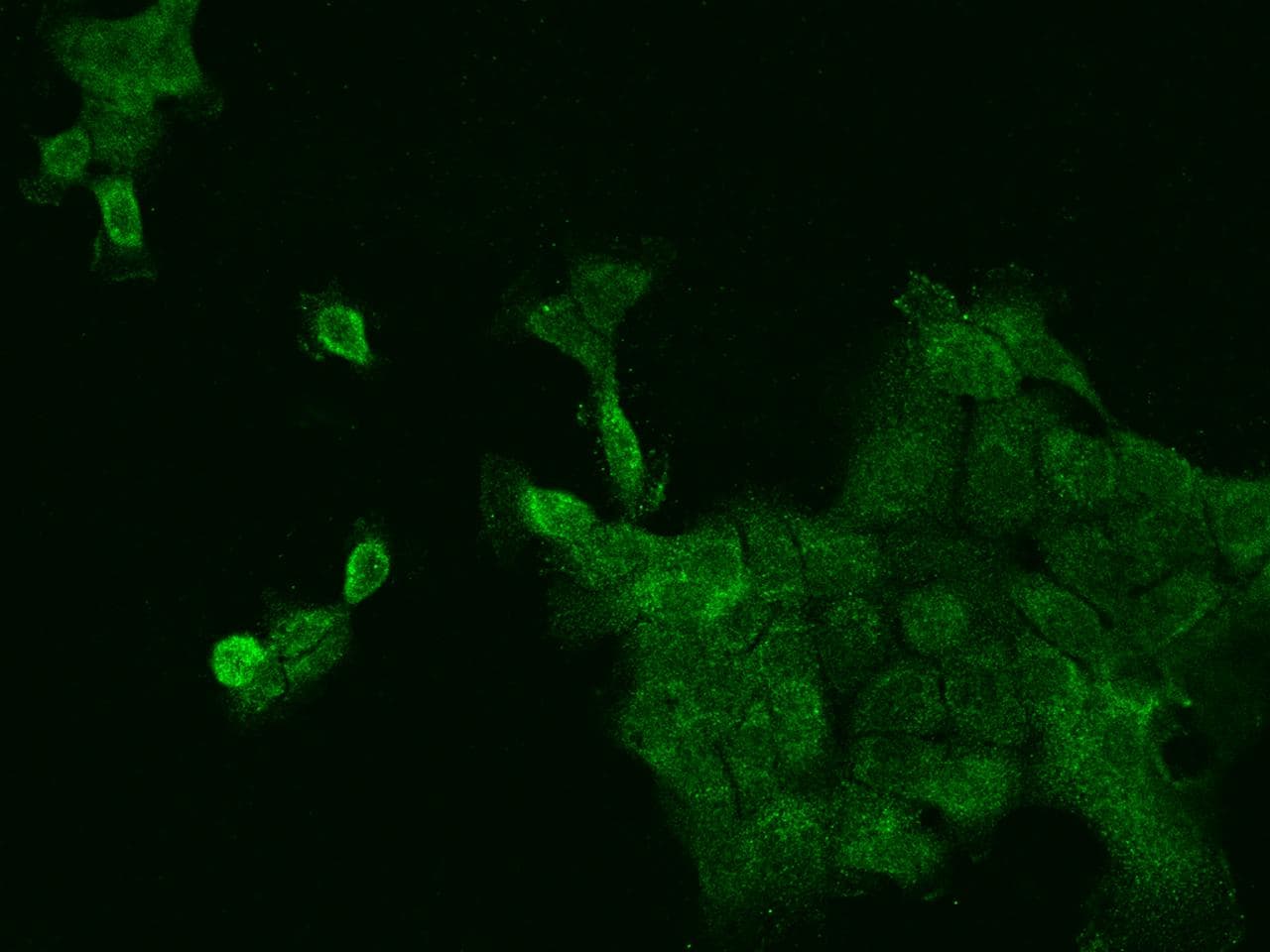 RPLP0 Antibody