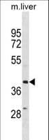 ZFP36L1 Antibody (aa64-93)