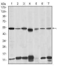 IHC-plus™ IRAK4 / IRAK-4 Antibody (clone 2H9)