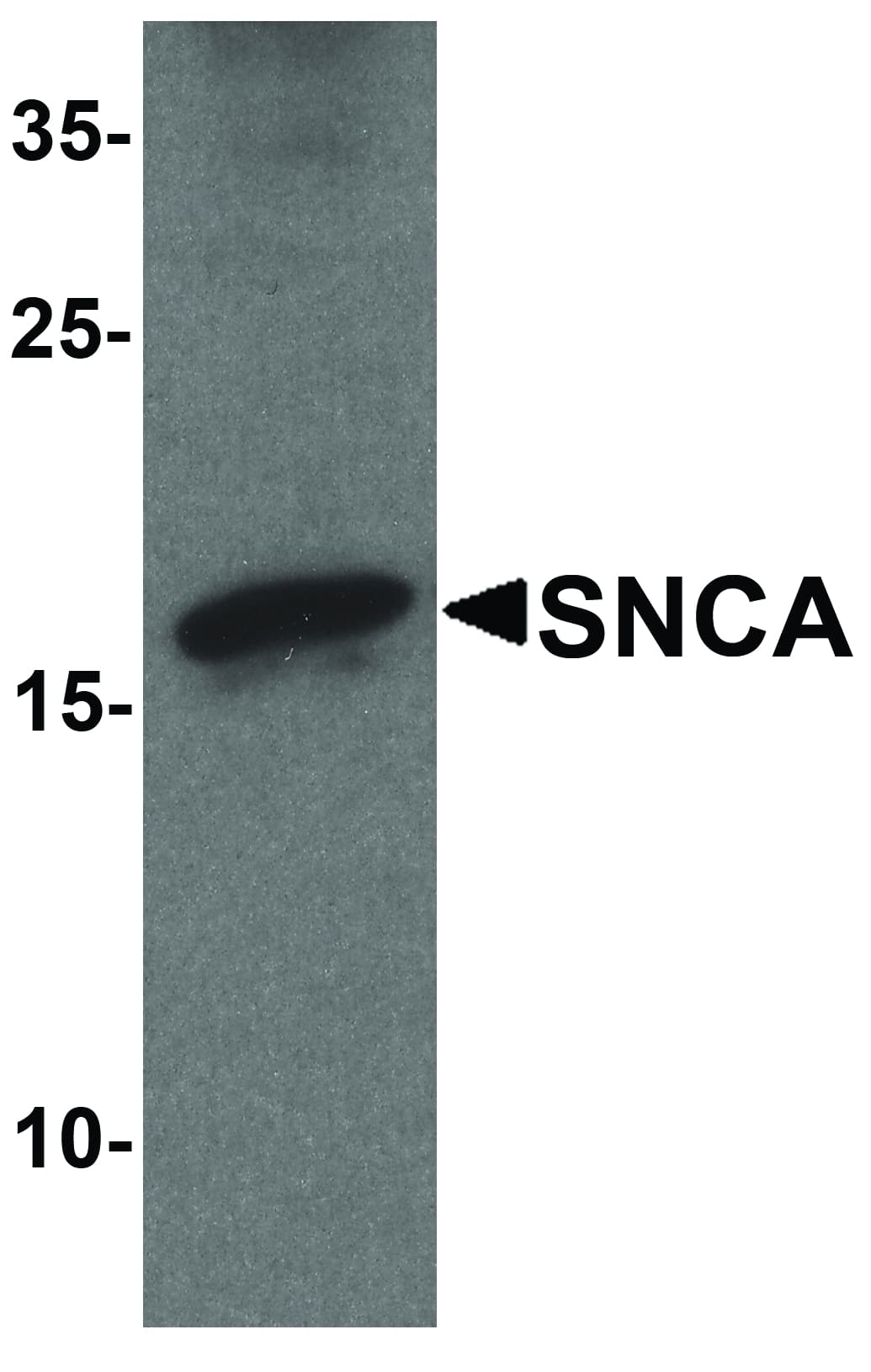 IHC-plus™ SNCA / Alpha-Synuclein Antibody