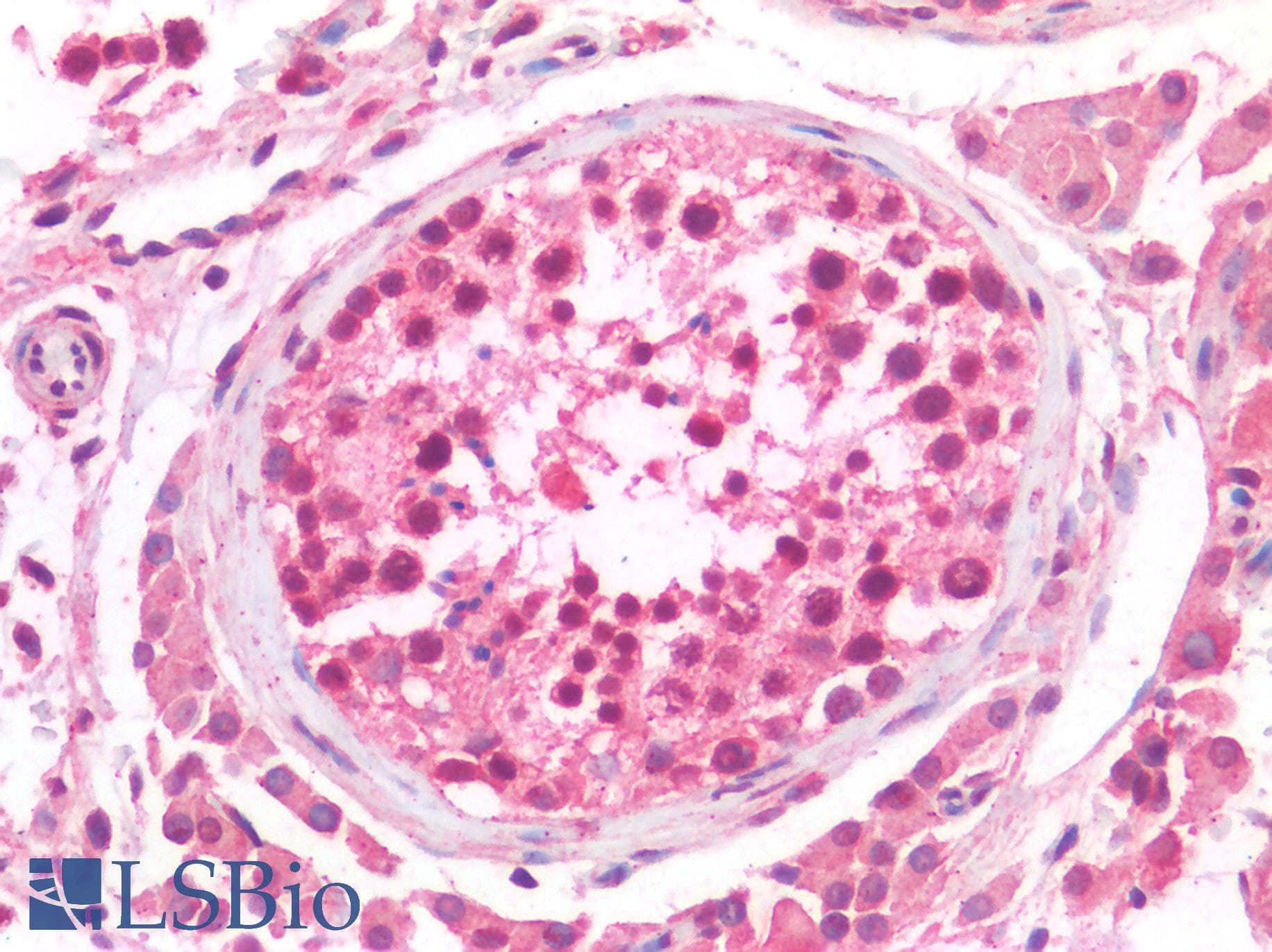 IHC-plus™ MAX Antibody