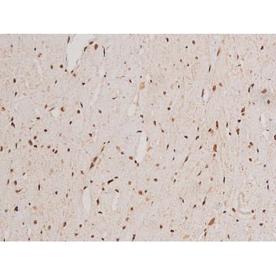 Polyclonal Rabbit anti-Human c-Kit / CD117 Antibody (IHC, IF, WB)