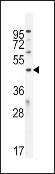 Polyclonal Rabbit anti-Human IPCEF1 / PIP3E Antibody (aa313-341, WB)