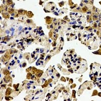 Polyclonal Rabbit anti-Human ZAP70 Antibody (Internal, IHC, IF, WB)