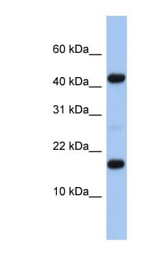 Polyclonal Rabbit anti-Human C5orf64 Antibody (N-Terminus, WB)