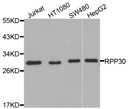 Polyclonal Rabbit anti-Human RPP30 Antibody (IHC, WB)