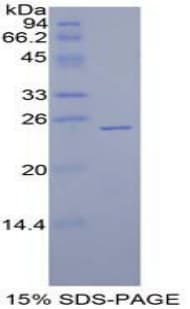 Human SPRY1 / Sprouty 1 Protein (Recombinant His-T7)