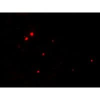 IHC-plus™ Polyclonal Rabbit anti-Human RNASET2 Antibody (IHC, IF, WB)