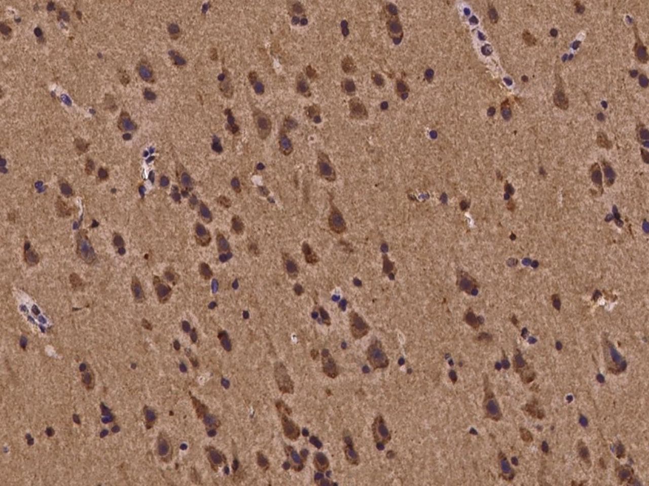 Polyclonal Rabbit anti-Human BMF Antibody (IHC, IF)