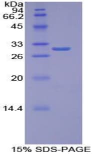 Human TOR1B / Torsin B Protein (Recombinant His-T7)