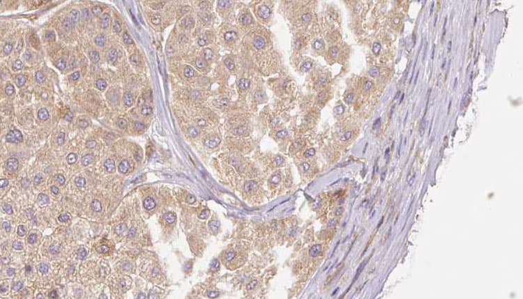 RLN2 / Relaxin 2 Antibody