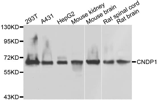 Polyclonal Rabbit anti-Human CNDP1 Antibody (IHC, WB)