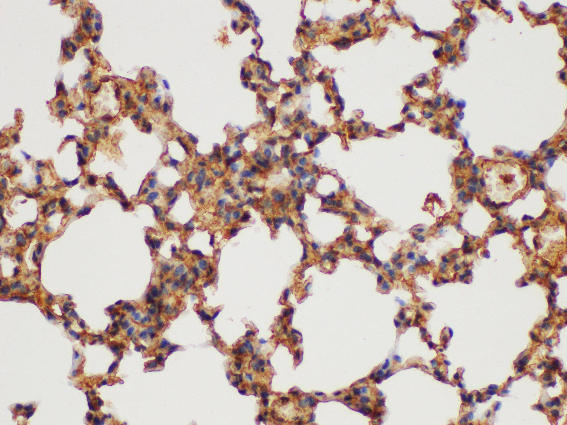 Polyclonal Rabbit anti-Mouse GSTP1 / GST Pi Antibody (IHC, WB)